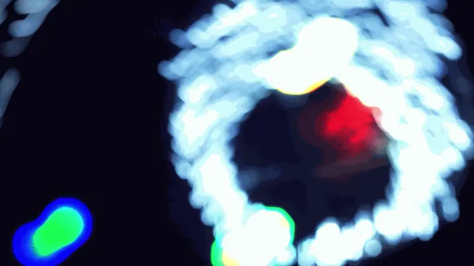 Photo clip